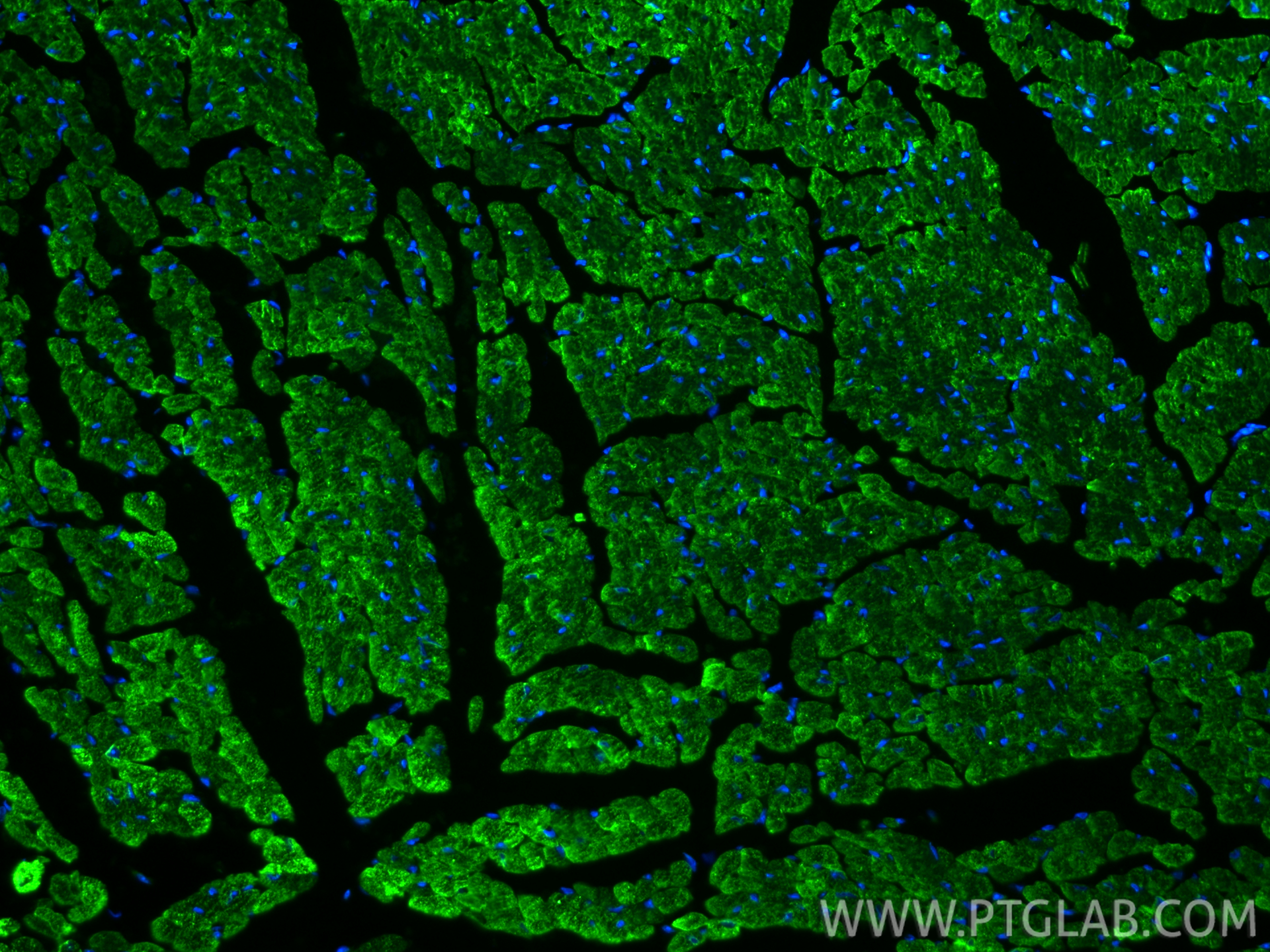 IF Staining of mouse heart using 86050-1-RR IF Staining of mouse heart using 86050-1-RR
