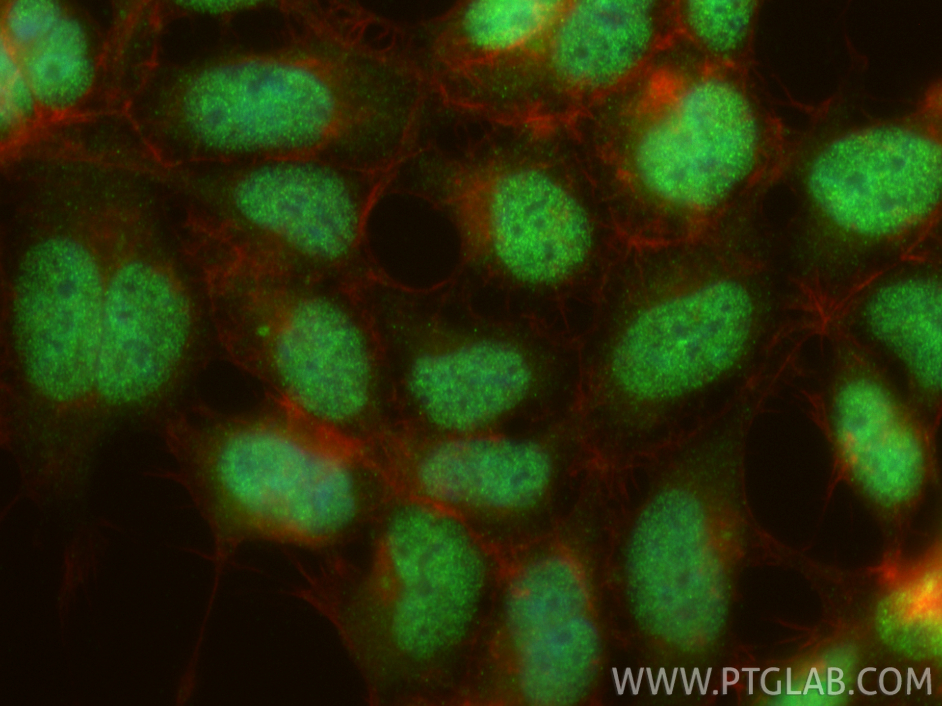 IF Staining of HEK-293 using 12725-1-AP