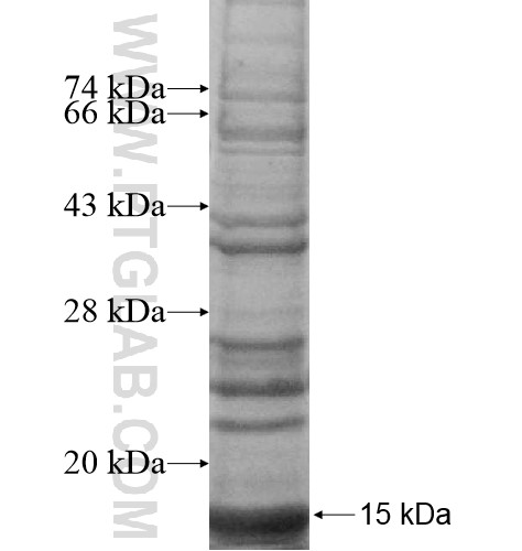 SERHL fusion protein Ag12618 SDS-PAGE SERHL fusion protein Ag12618 SDS-PAGE