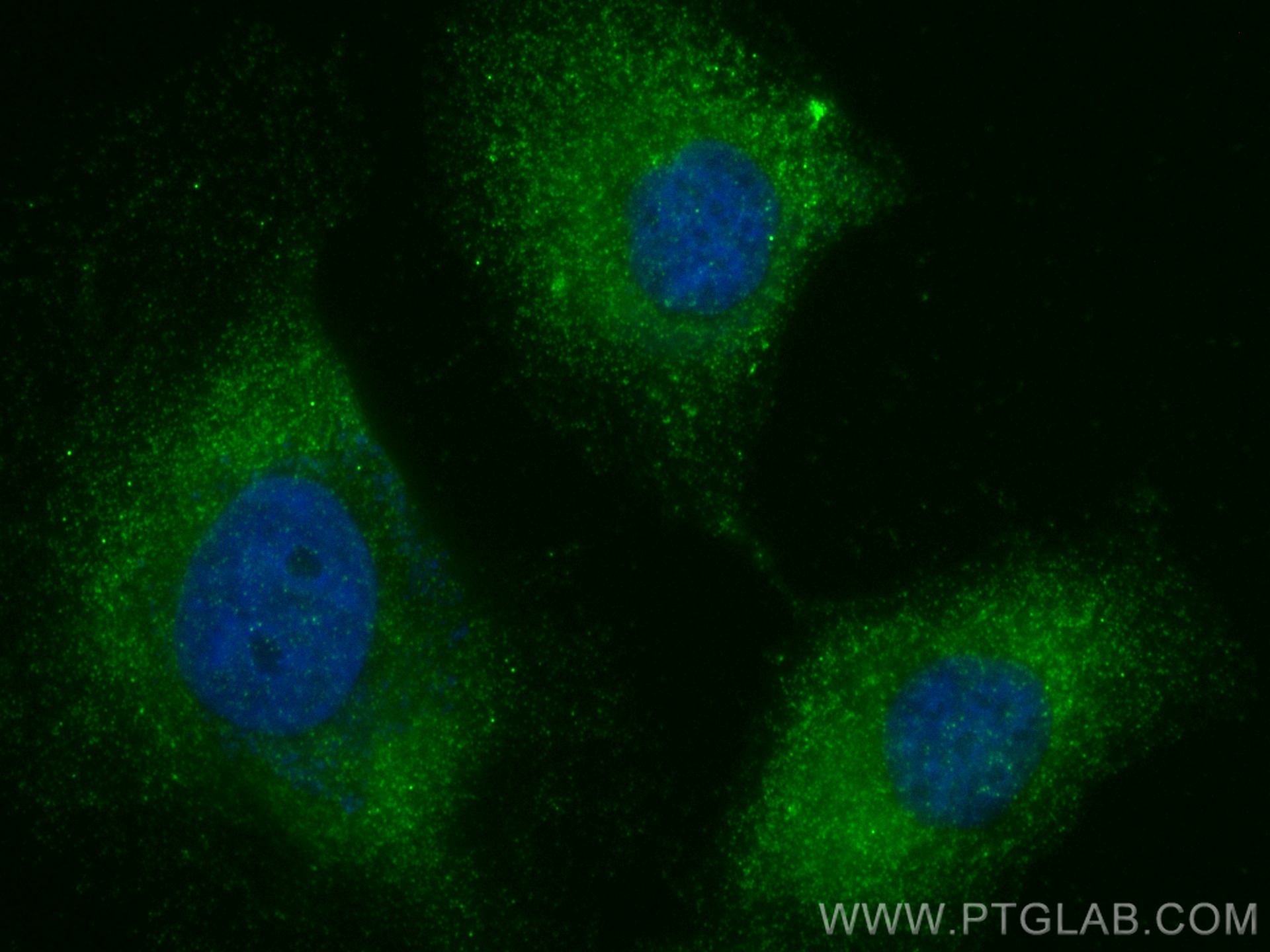 IF Staining of HeLa using 17807-1-AP