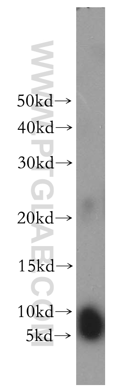 WB analysis of mouse brain using 17807-1-AP