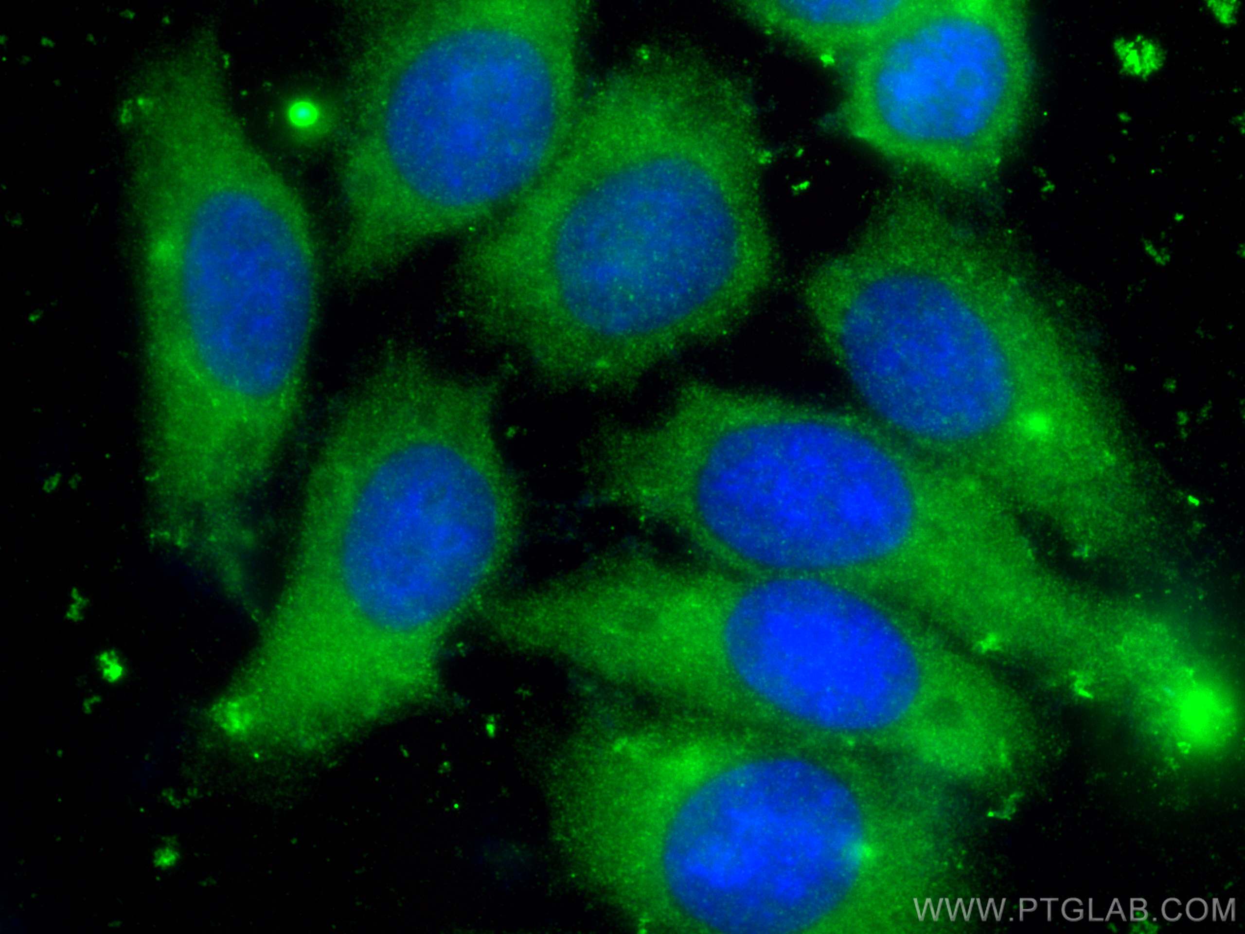 IF Staining of HepG2 using 16382-1-AP