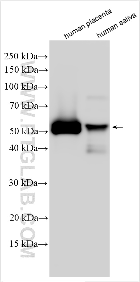 WB analysis using 16382-1-AP