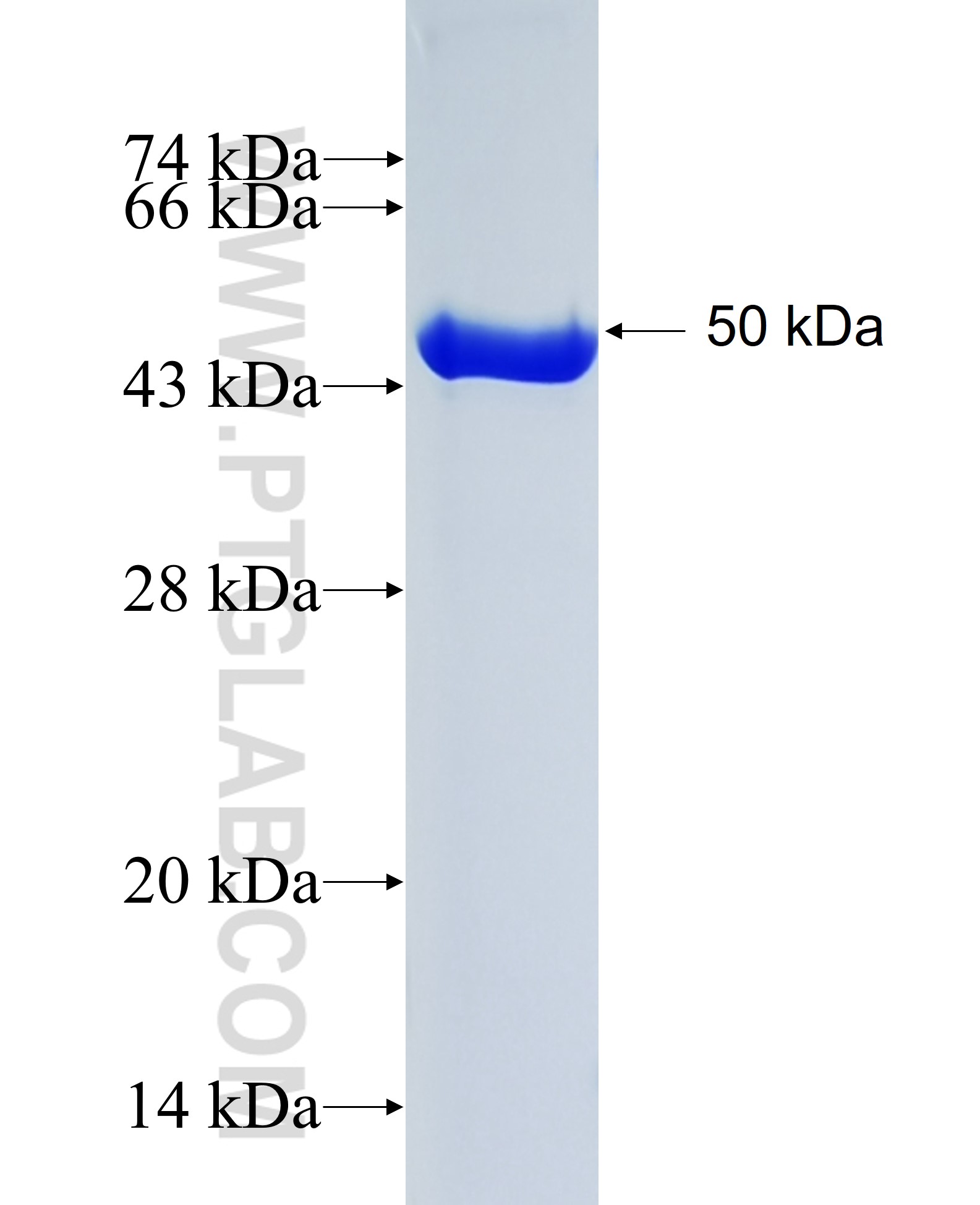 Alpha-1-Antitrypsin fusion protein Ag9516 SDS-PAGE