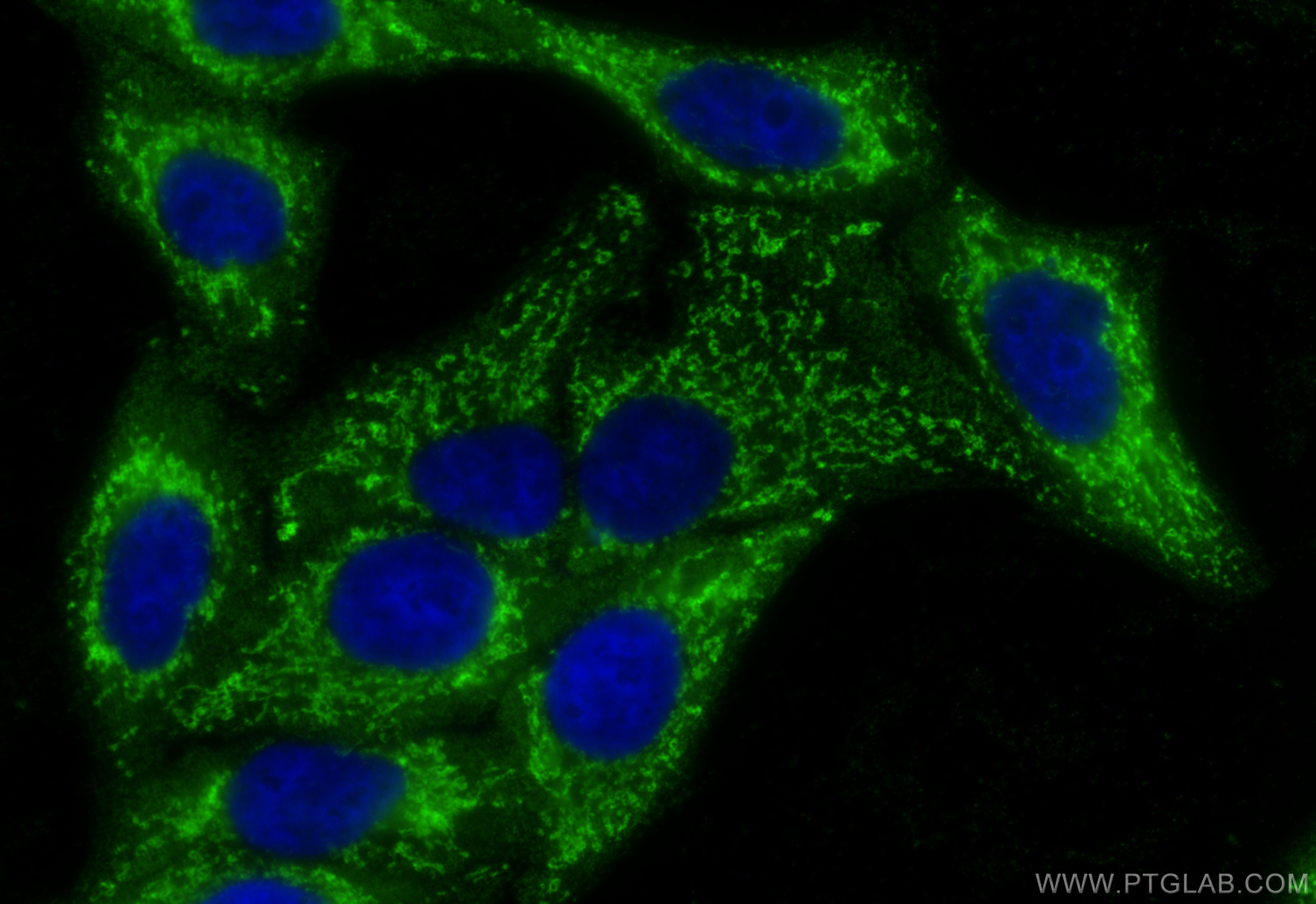 IF Staining of HepG2 using 60113-1-Ig