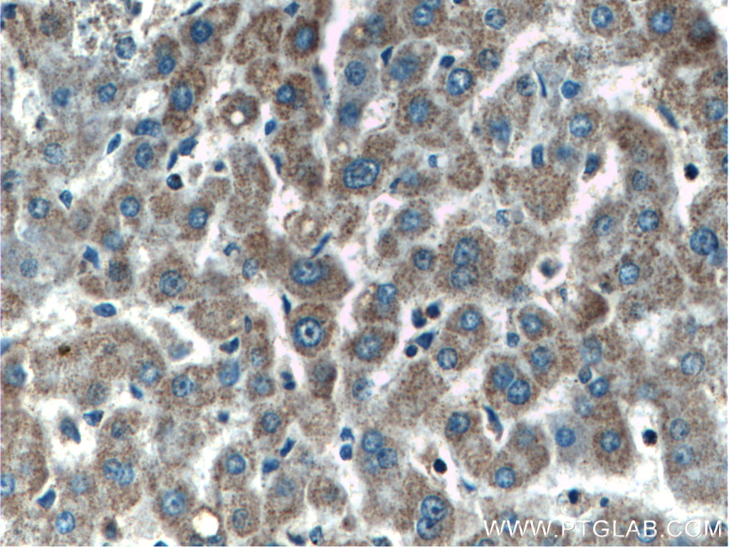 IHC staining of human liver using 60113-1-Ig