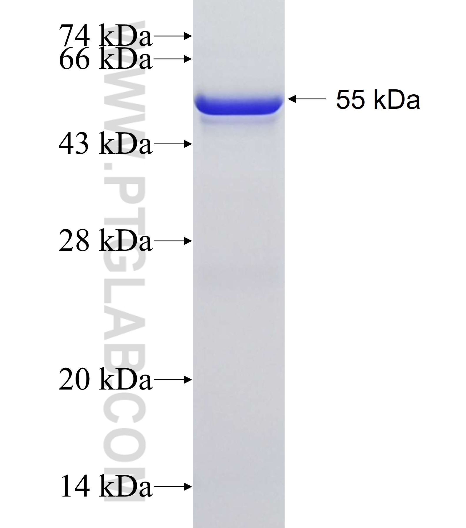 SERPINA10 fusion protein Ag13651 SDS-PAGE SERPINA10 fusion protein Ag13651 SDS-PAGE