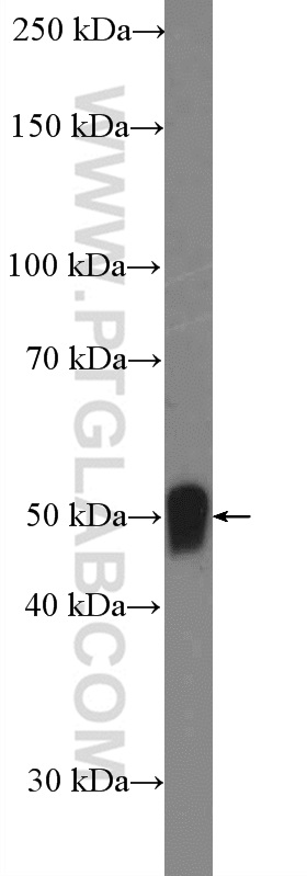 WB analysis of human adipose using 17451-1-AP