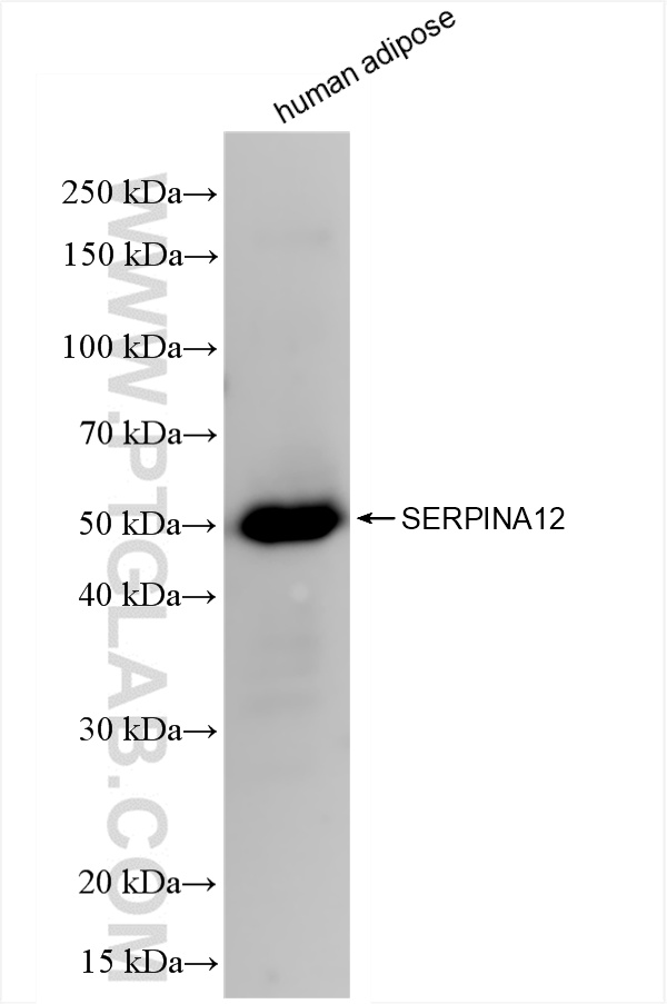 WB analysis of human adipose using 85908-5-RR