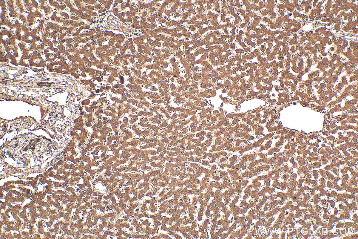 IHC staining of human liver using 12192-1-AP