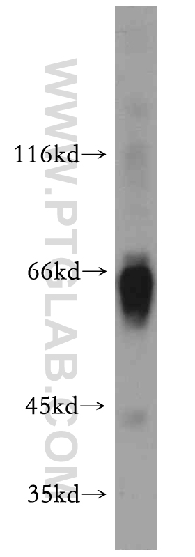 WB analysis of human plasma using 12192-1-AP