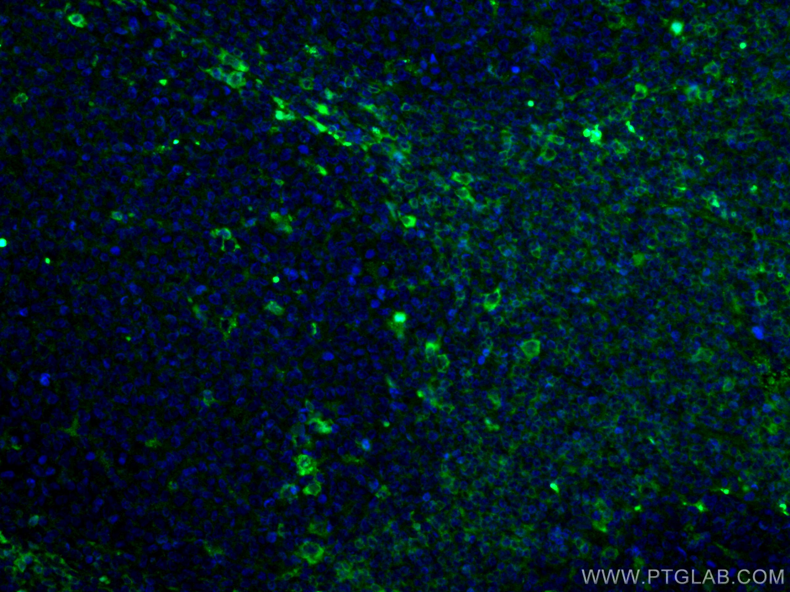 IF Staining of human tonsillitis using 66078-1-Ig