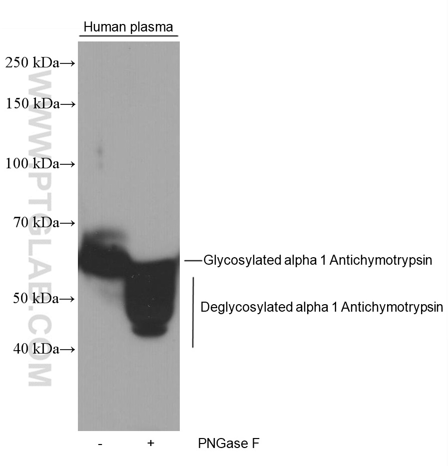 WB analysis of human plasma using 66078-1-Ig