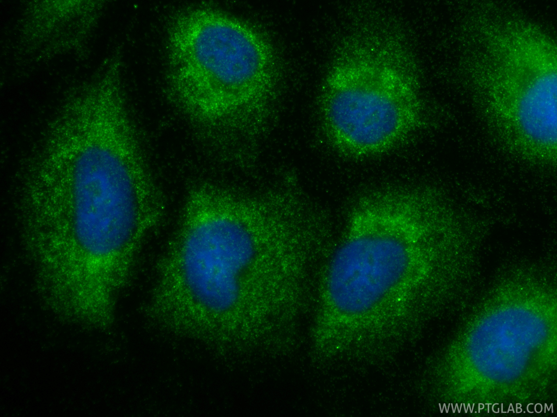 IF Staining of A549 using 12010-1-AP (same clone as 12010-1-PBS)