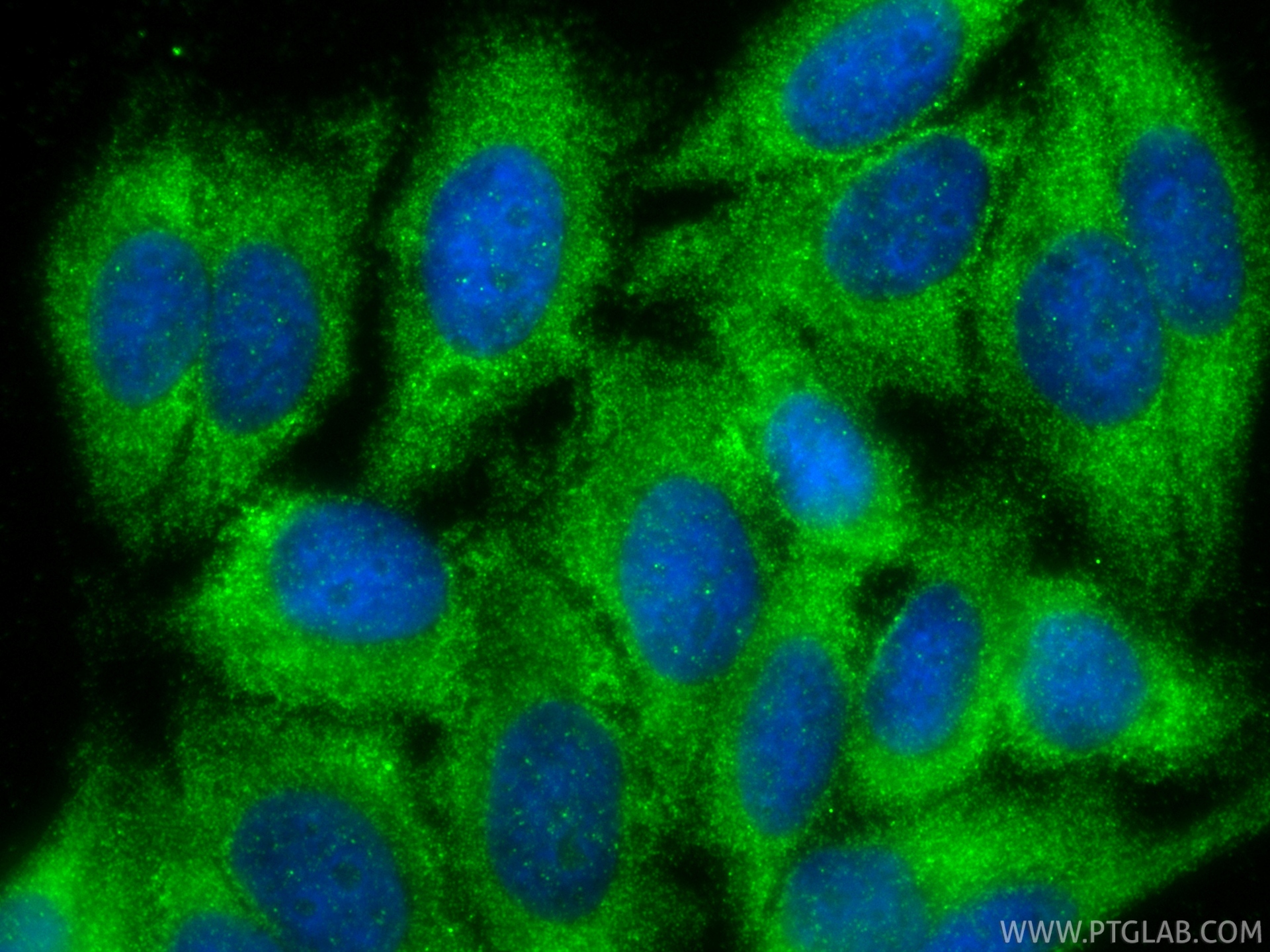 IF Staining of HepG2 using 12010-1-AP (same clone as 12010-1-PBS)