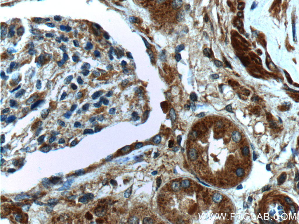IHC staining of human kidney using 12010-1-AP