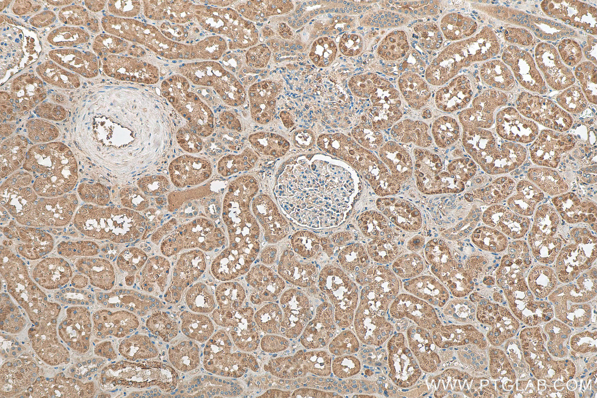 IHC staining of human kidney using 29931-1-AP