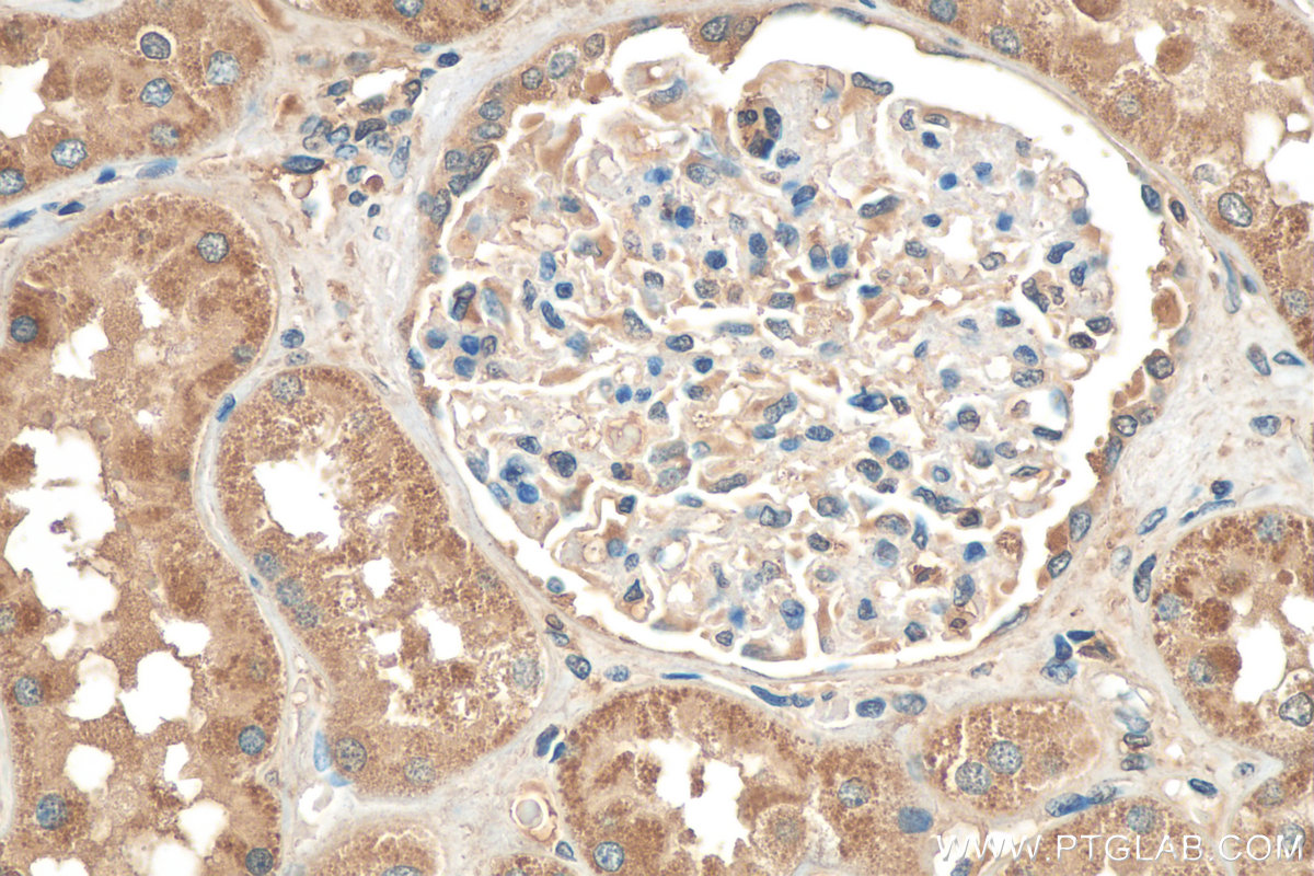 IHC staining of human kidney using 29931-1-AP