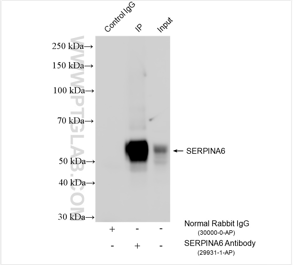 IP experiment of human placenta using 29931-1-AP