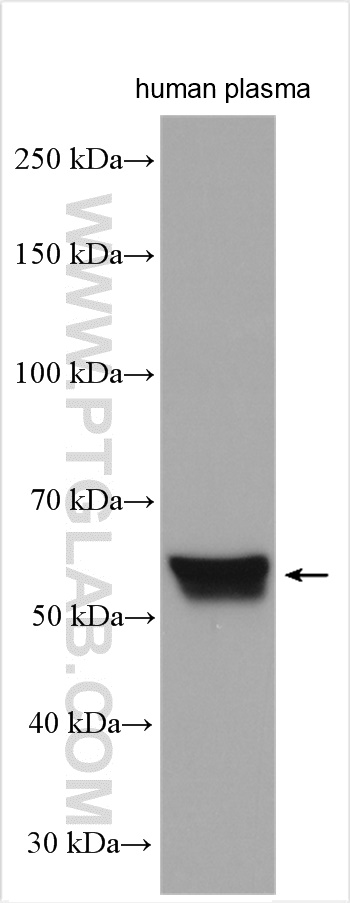 WB analysis of human plasma using 29931-1-AP