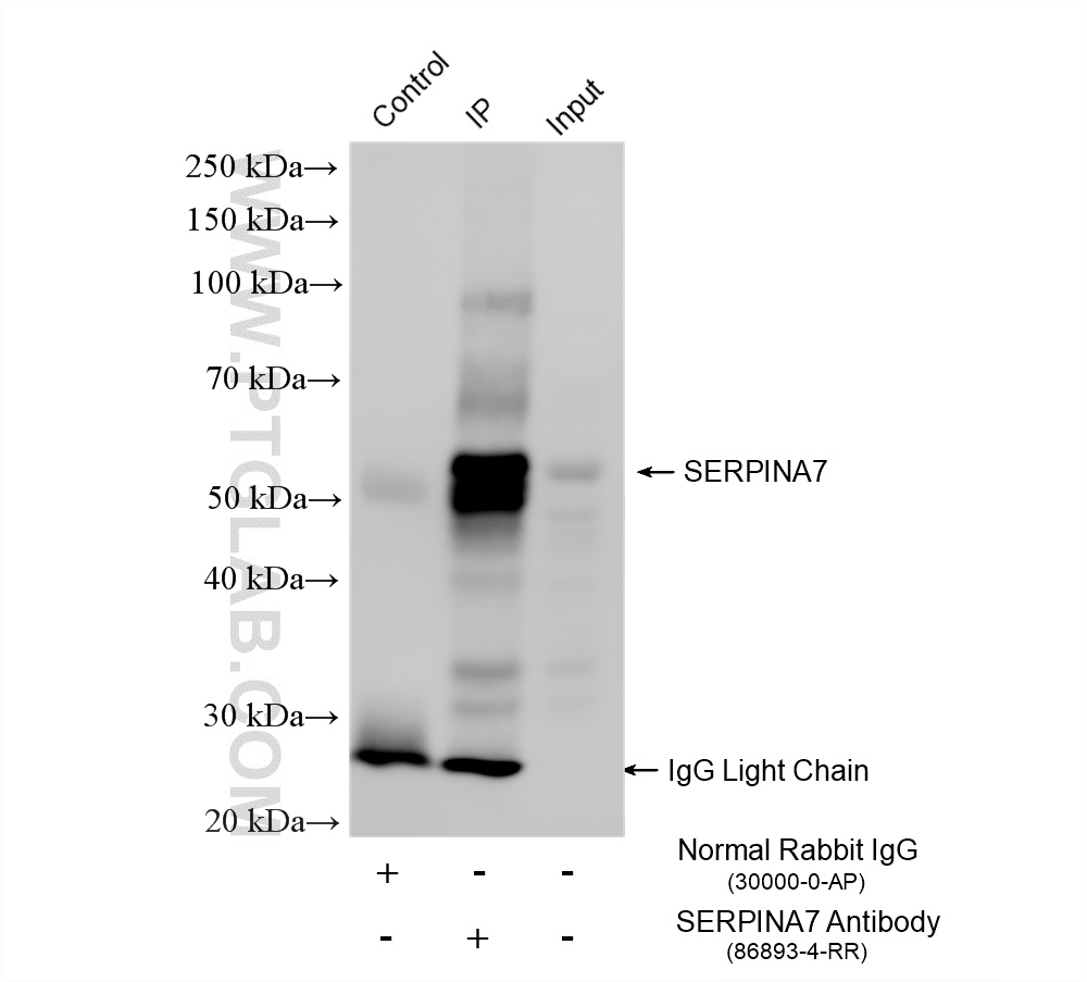 IP experiment of HepG2 using 86893-4-RR (same clone as 86893-4-PBS)