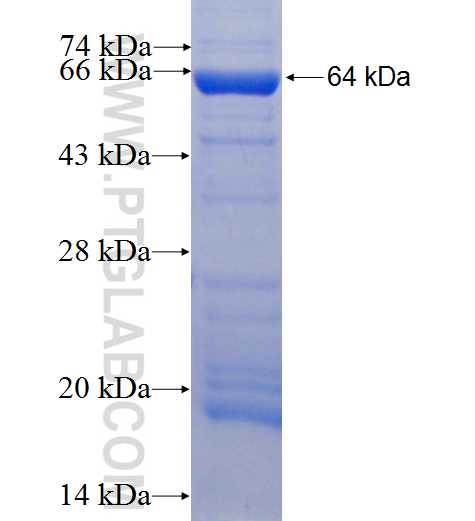 SERPINA7 fusion protein Ag9781 SDS-PAGE SERPINA7 fusion protein Ag9781 SDS-PAGE