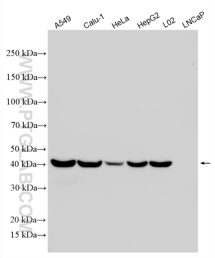 Various lysates were subjected to SDS PAGE followed by western blot with 33756-1-AP (SERPINB1 antibody) at dilution of 1:2000 incubated at room temperature for 1.5 hours. WB analysis using 33756-1-AP