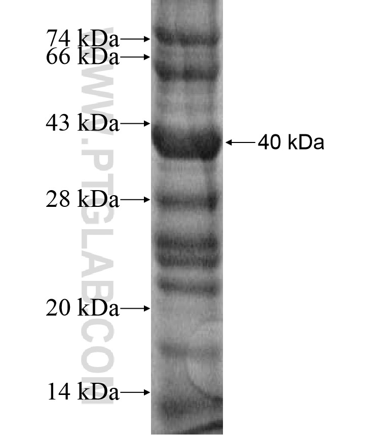 SERPINB10 fusion protein Ag16766 SDS-PAGE SERPINB10 fusion protein Ag16766 SDS-PAGE