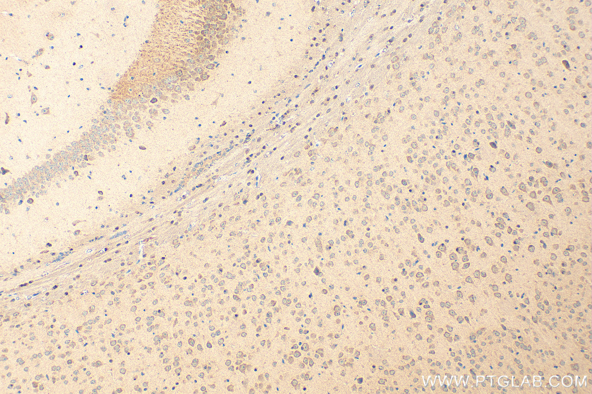 Immunohistochemical analysis of paraffin-embedded mouse brain tissue slide using 16035-1-AP (SERPINB2 antibody) at dilution of 1:200 (under 10x lens). Heat mediated antigen retrieval with Tris-EDTA buffer (pH 9.0). IHC staining of mouse brain using 16035-1-AP