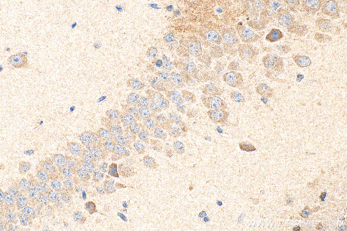 Immunohistochemical analysis of paraffin-embedded mouse brain tissue slide using 16035-1-AP (SERPINB2 antibody) at dilution of 1:200 (under 40x lens). Heat mediated antigen retrieval with Tris-EDTA buffer (pH 9.0). IHC staining of mouse brain using 16035-1-AP