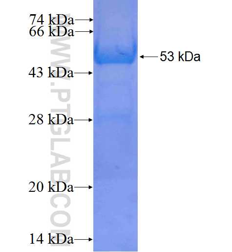 SERPINB2 fusion protein Ag9319 SDS-PAGE SERPINB2 fusion protein Ag9319 SDS-PAGE