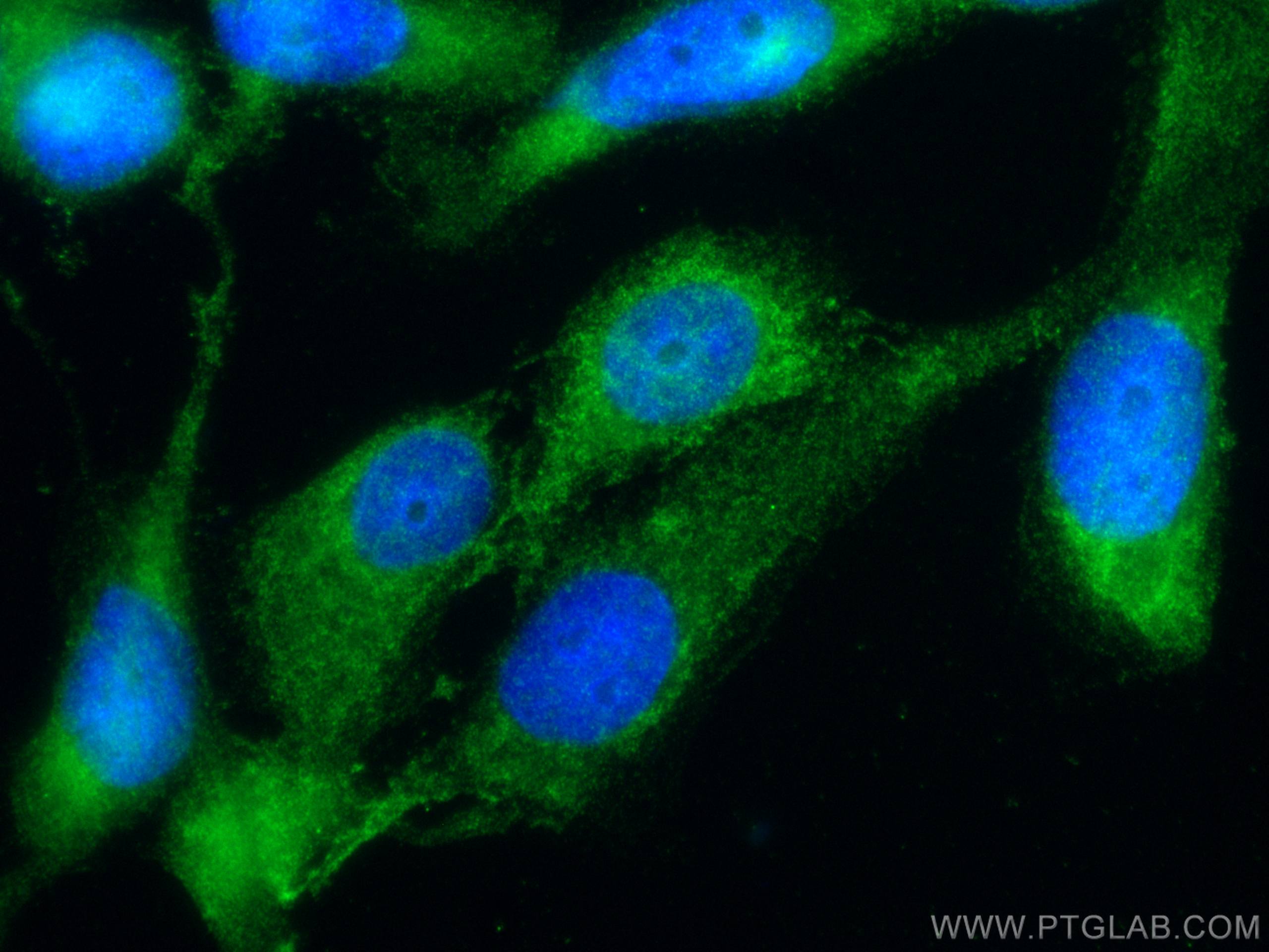 IF Staining of A431 using 11722-1-AP