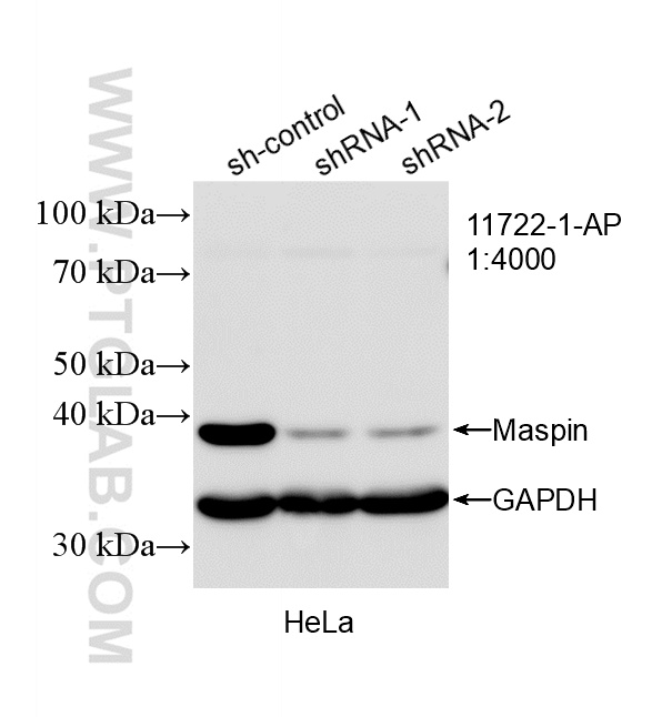 WB result of Maspin antibody (11722-1-AP; 1:4000; incubated at room temperature for 1.5 hours) with sh-Control and sh-Maspin transfected HeLa cells. WB analysis of HeLa using 11722-1-AP