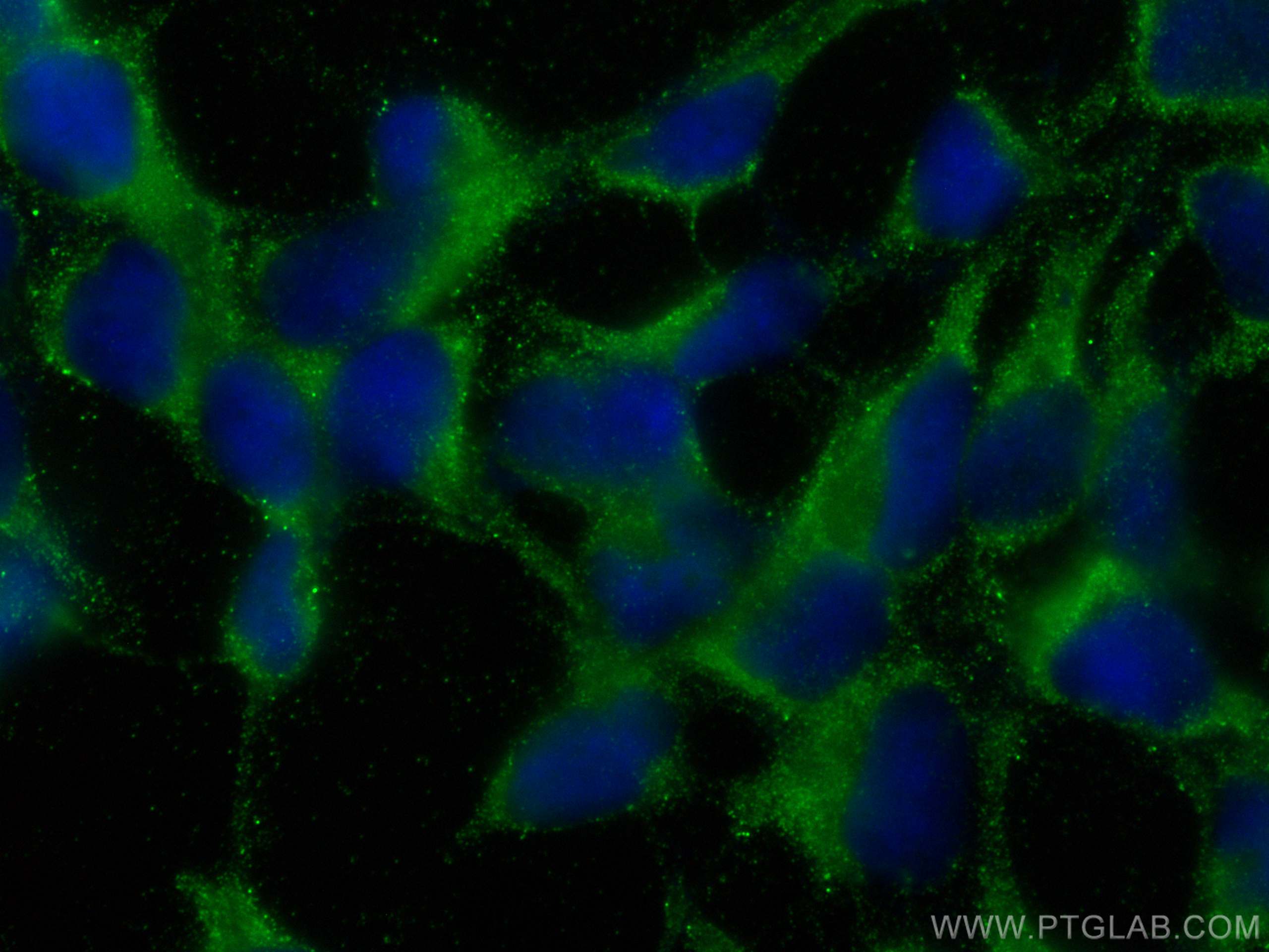 IF Staining of HEK-293 using 67633-1-Ig