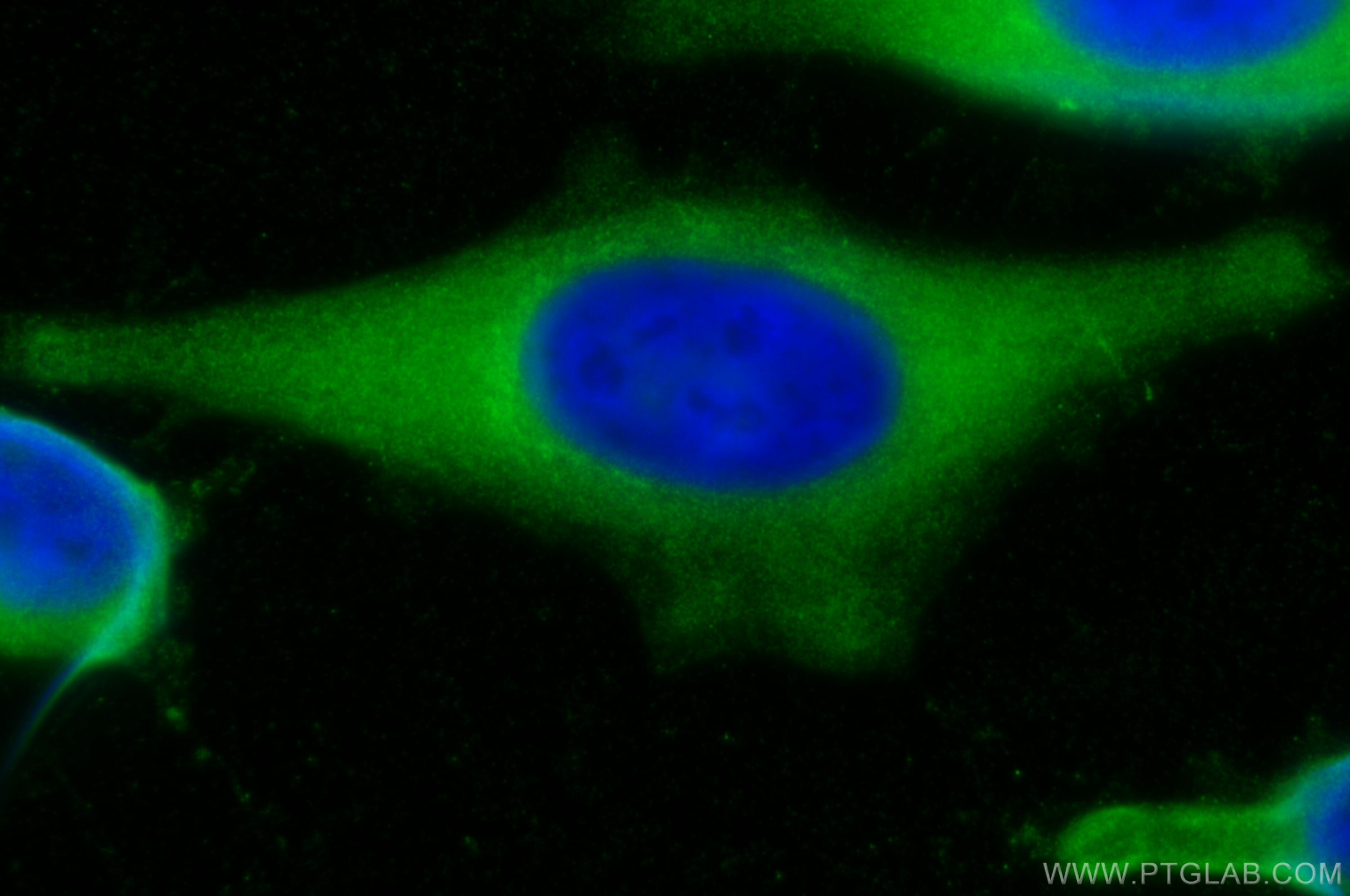 IF Staining of HeLa using 14962-1-AP