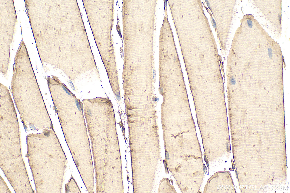 Immunohistochemical analysis of paraffin-embedded mouse skeletal muscle tissue slide using 14962-1-AP (SERPINB6 antibody) at dilution of 1:200 (under 40x lens). Heat mediated antigen retrieval with Tris-EDTA buffer (pH 9.0). IHC staining of mouse skeletal muscle using 14962-1-AP