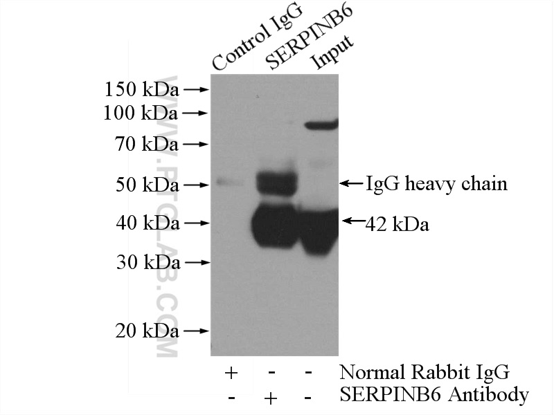 IP experiment of human placenta using 14962-1-AP