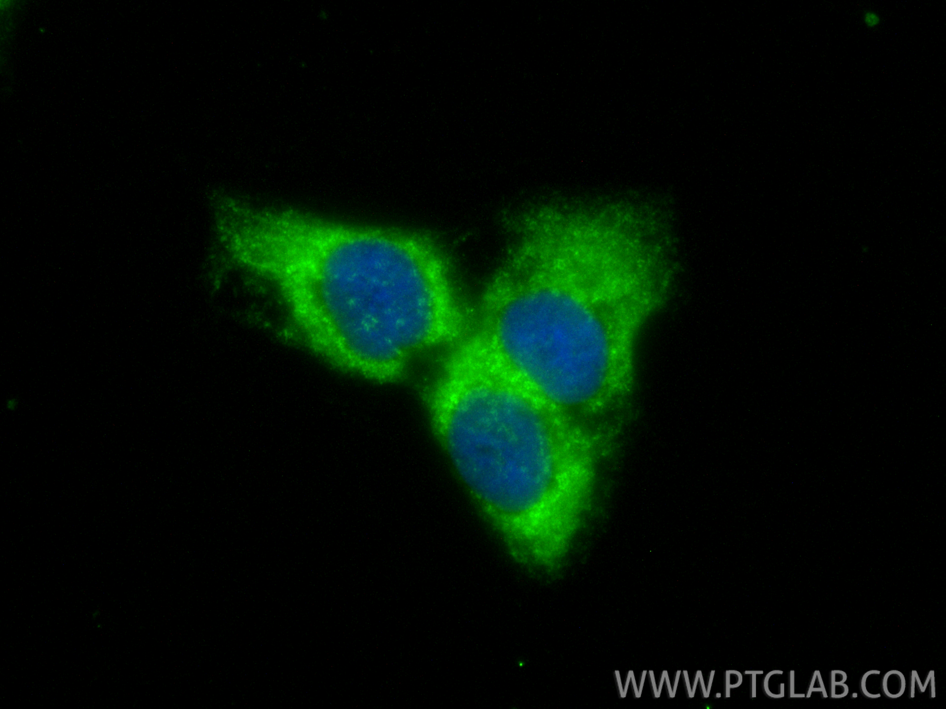 IF Staining of HaCaT using 21170-1-AP IF Staining of HaCaT using 21170-1-AP