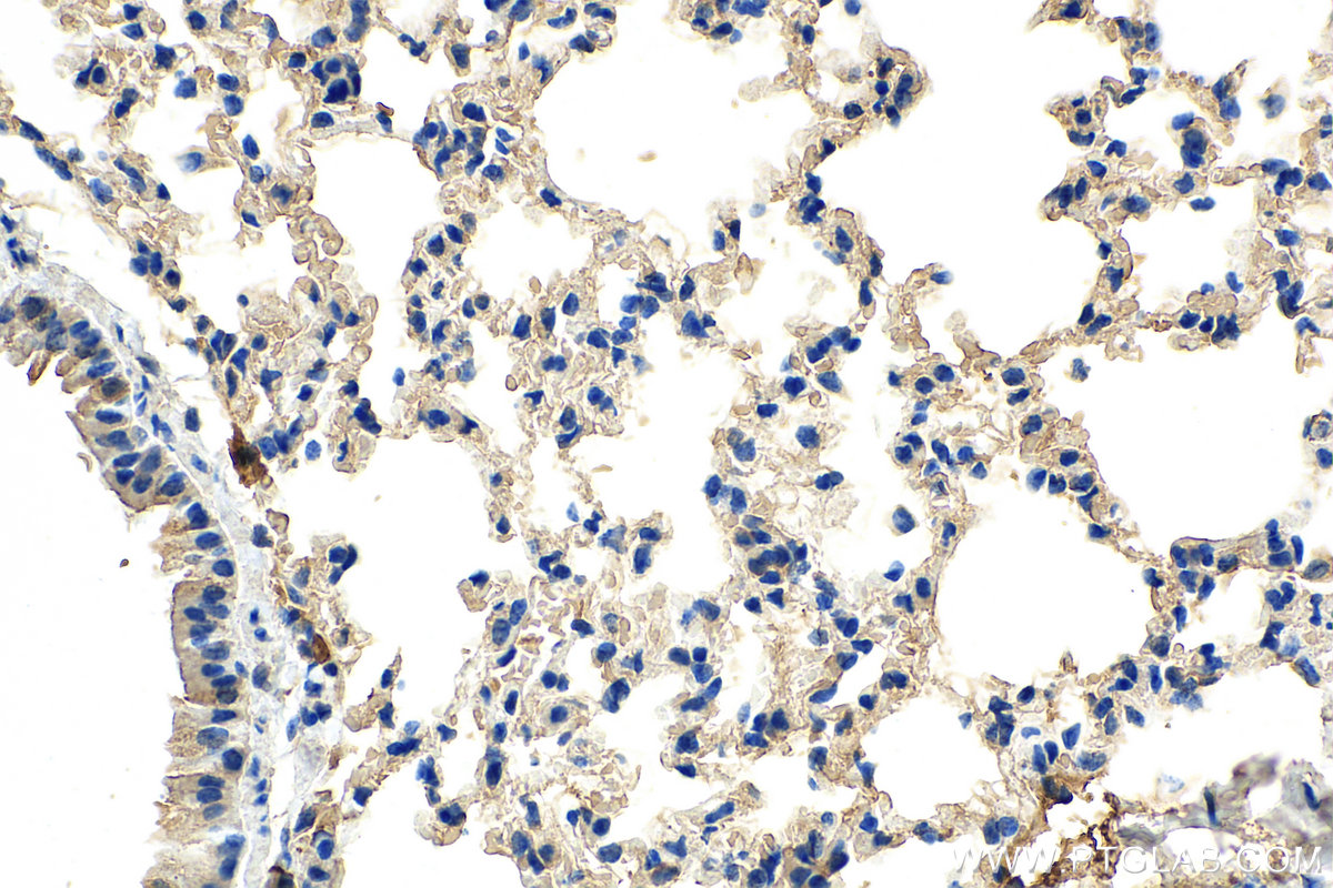 IHC staining of mouse lung using 67950-1-Ig (same clone as 67950-1-PBS)