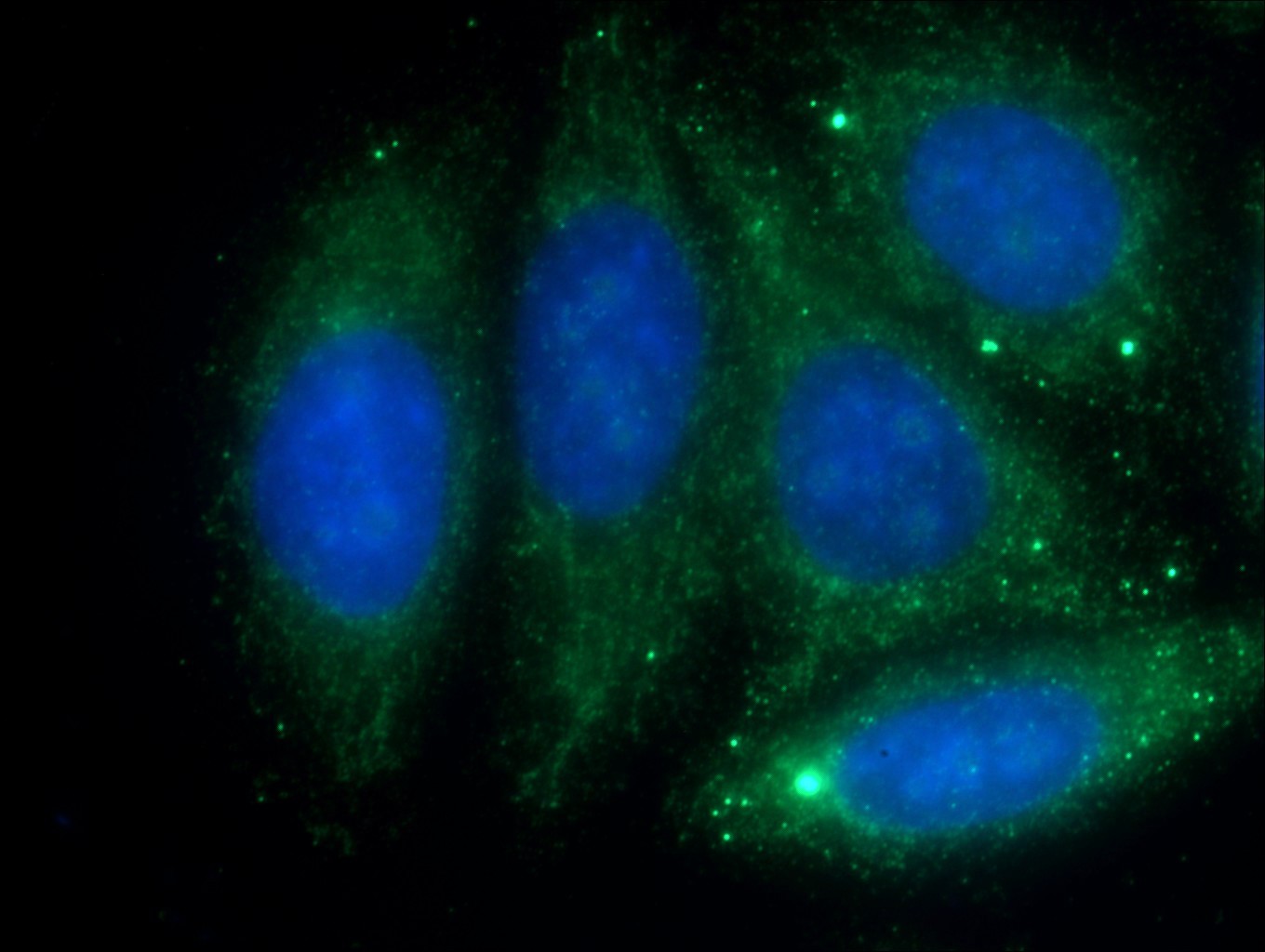 IF Staining of HepG2 using 16414-1-AP