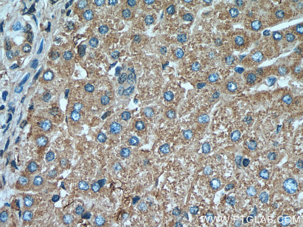 IHC staining of human liver using 67602-1-Ig