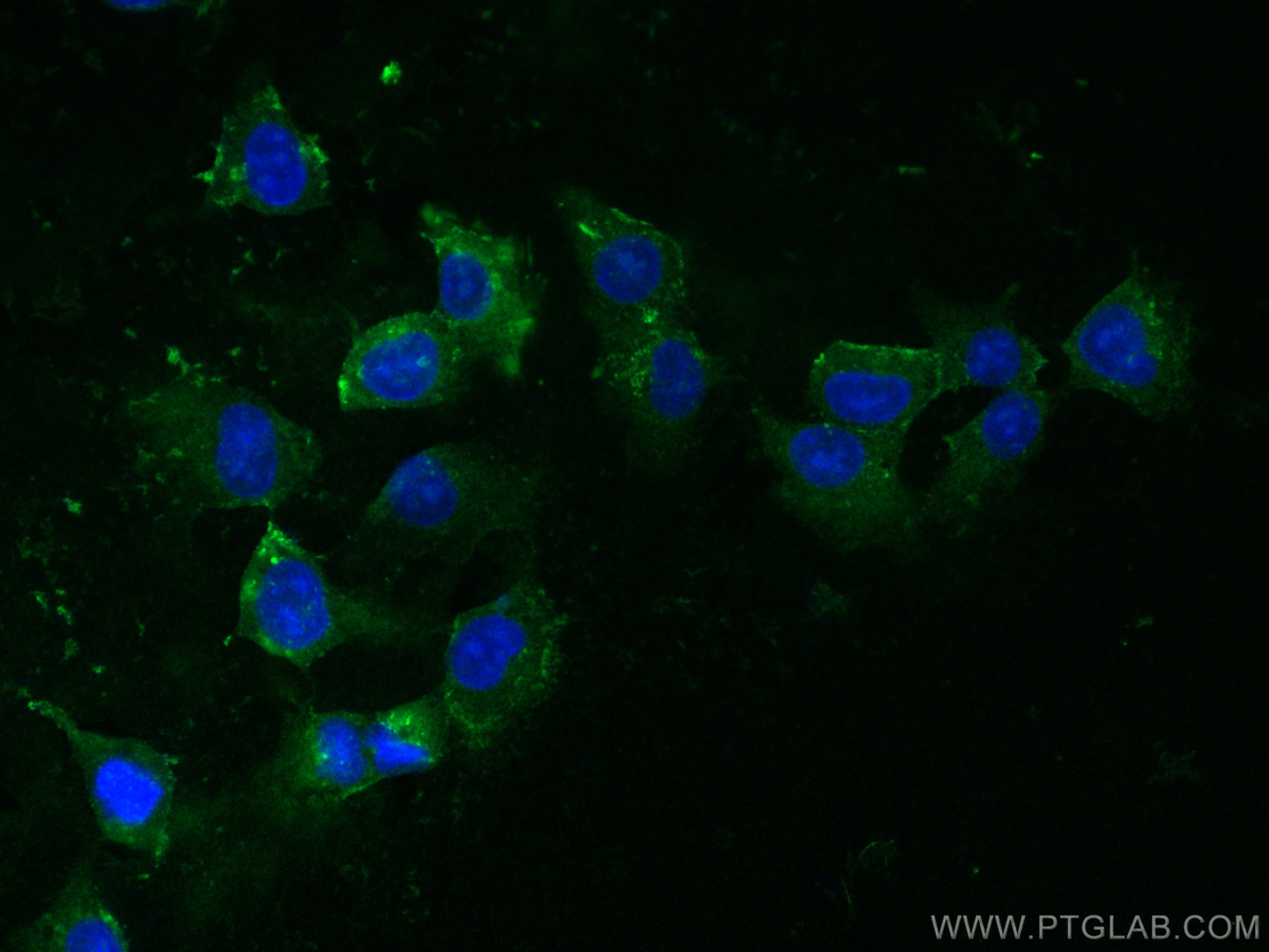 IF Staining of HUVEC using 13801-1-AP