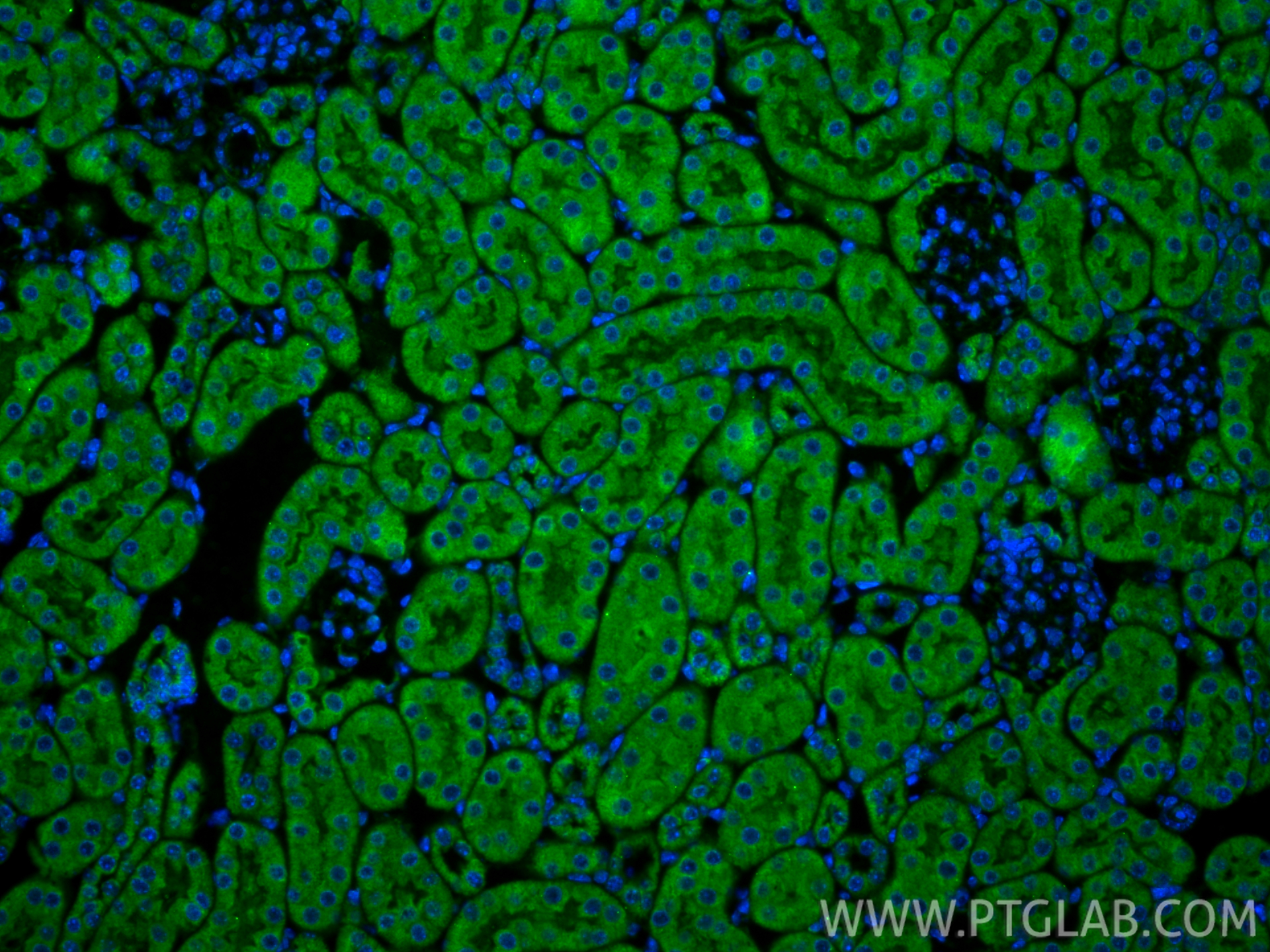 IF Staining of mouse kidney using 13801-1-AP IF Staining of mouse kidney using 13801-1-AP