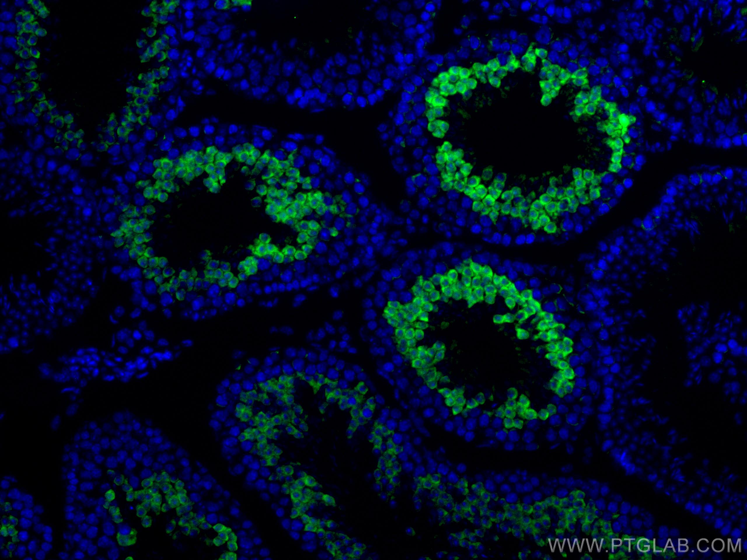 IF Staining of human testis using 11303-1-AP