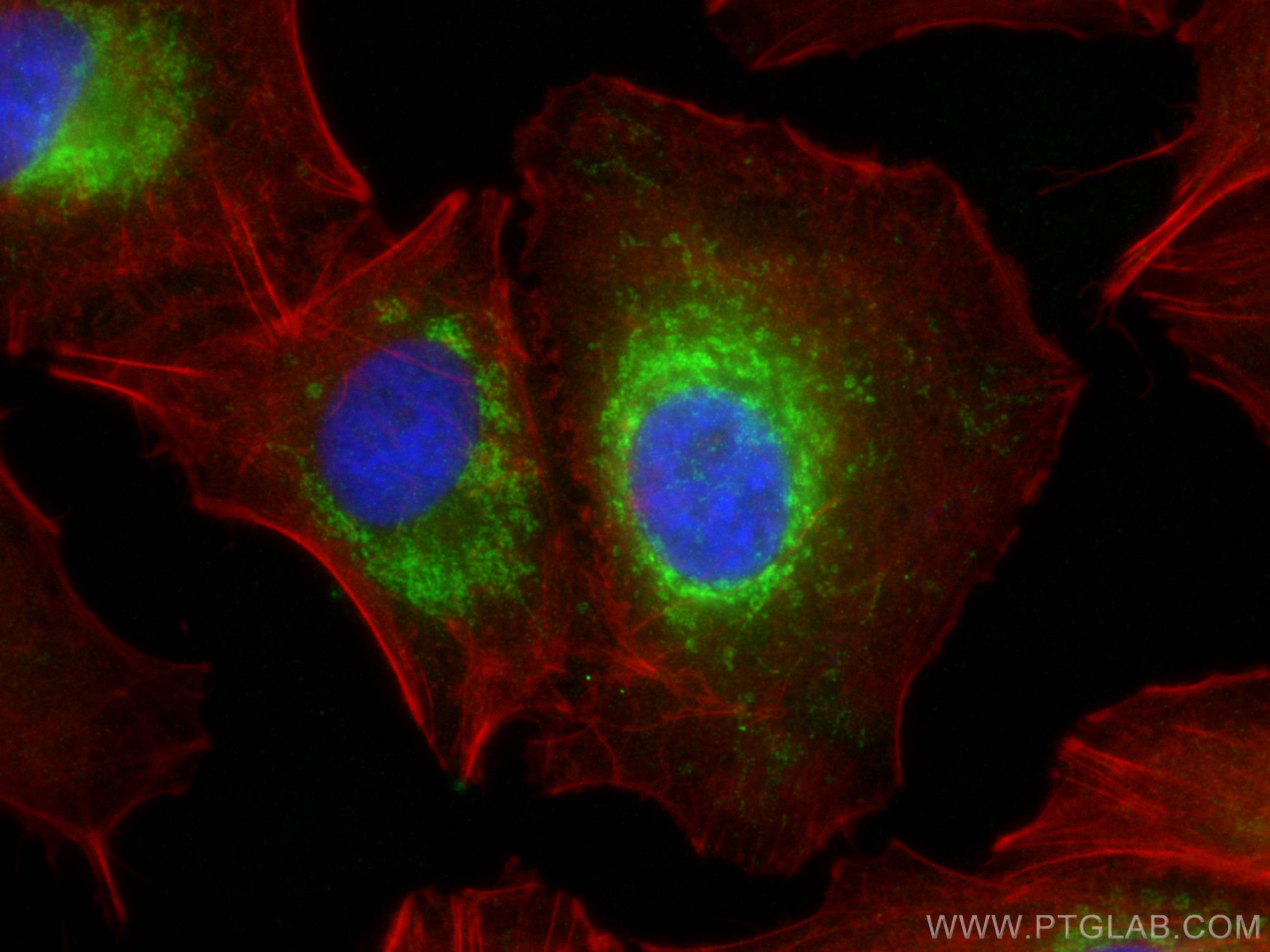 IF Staining of A549 using 11303-1-AP