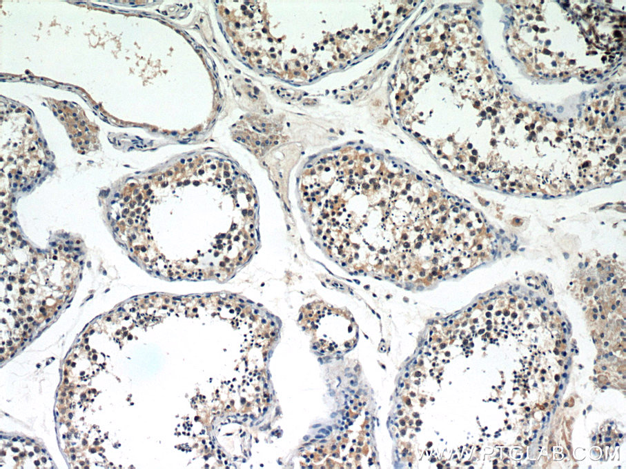 IHC staining of human testis using 11303-1-AP