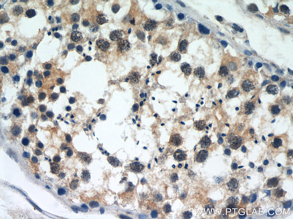 IHC staining of human testis using 11303-1-AP