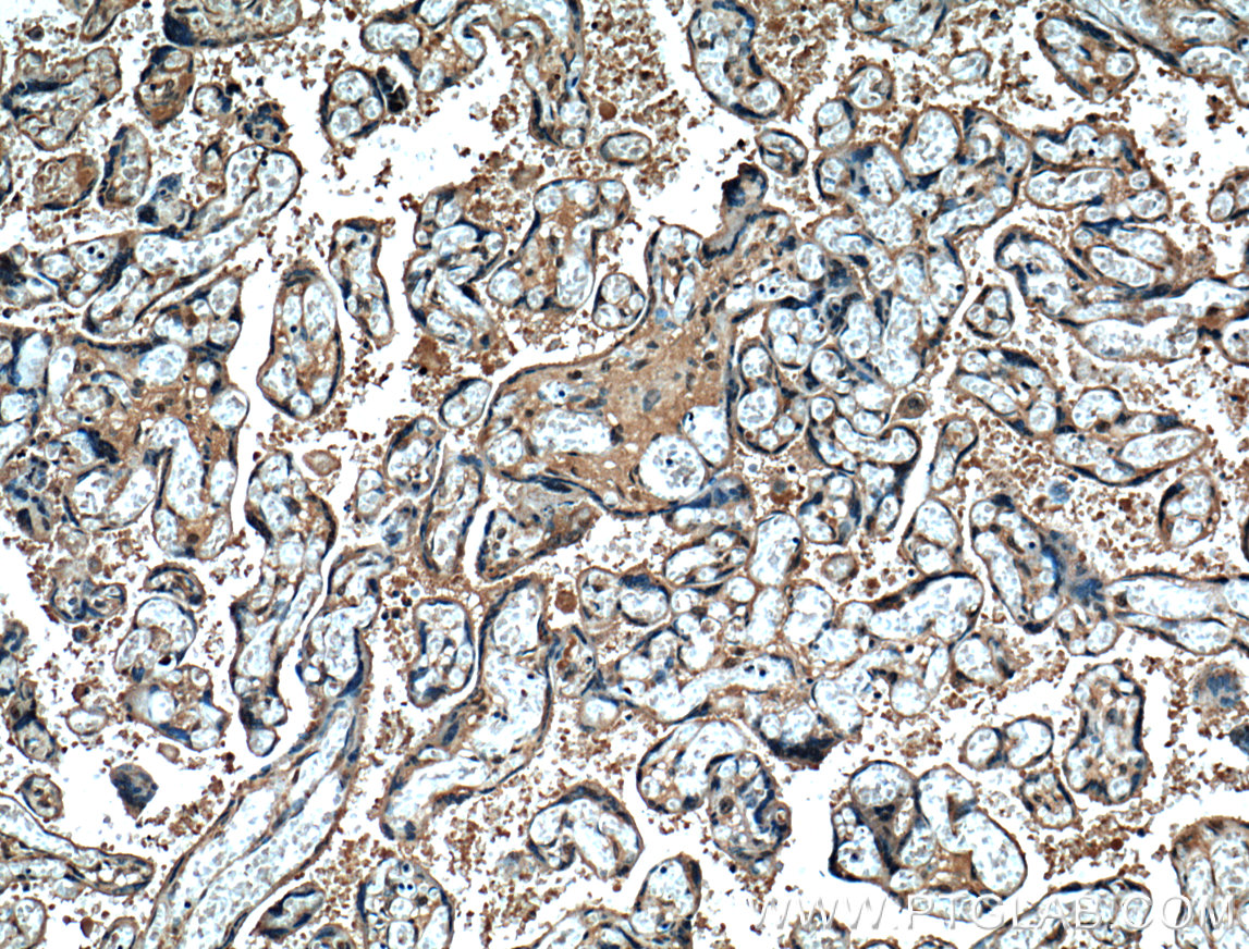 IHC staining of human placenta using 66203-1-Ig