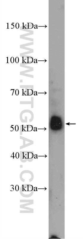 WB analysis of HepG2 using 13228-1-AP