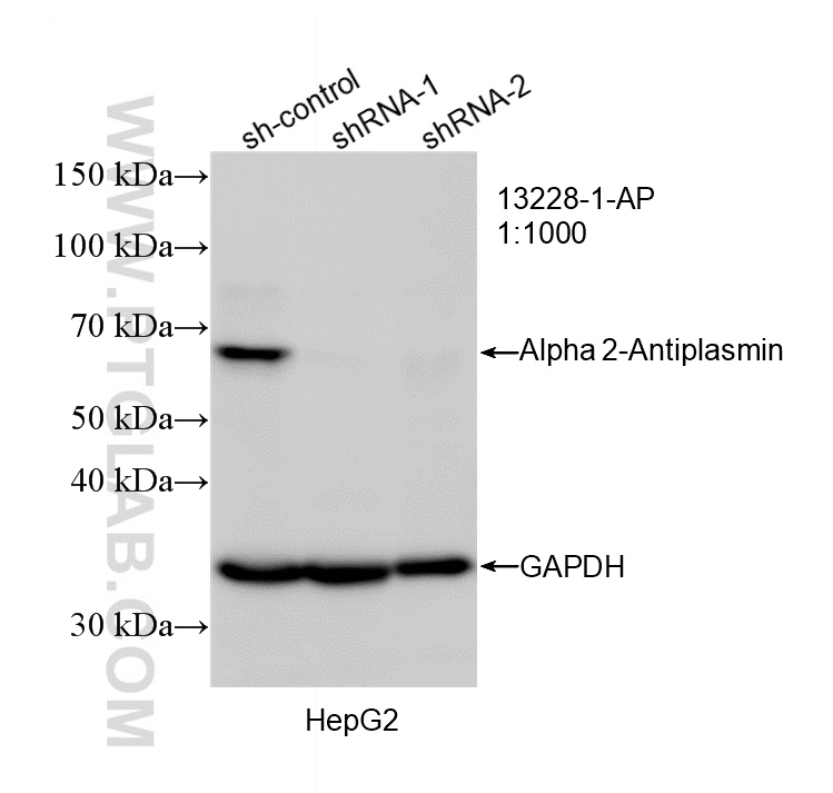 WB result of Alpha 2-Antiplasmin antibody (13228-1-AP; 1:1000; incubated at room temperature for 1.5 hours) with sh-Control and sh-Alpha 2-Antiplasmin transfected HepG2 cells. WB analysis of HepG2 using 13228-1-AP